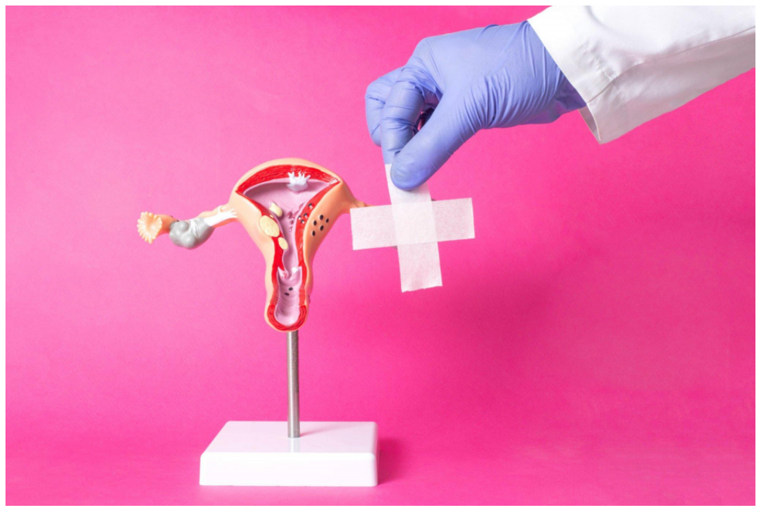 Ovarian cyst removal surgery in hyderabad what to expect gmoney loans